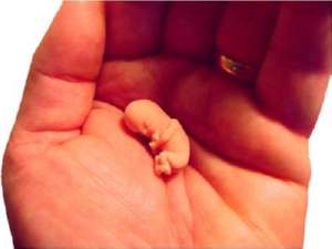 human foetus